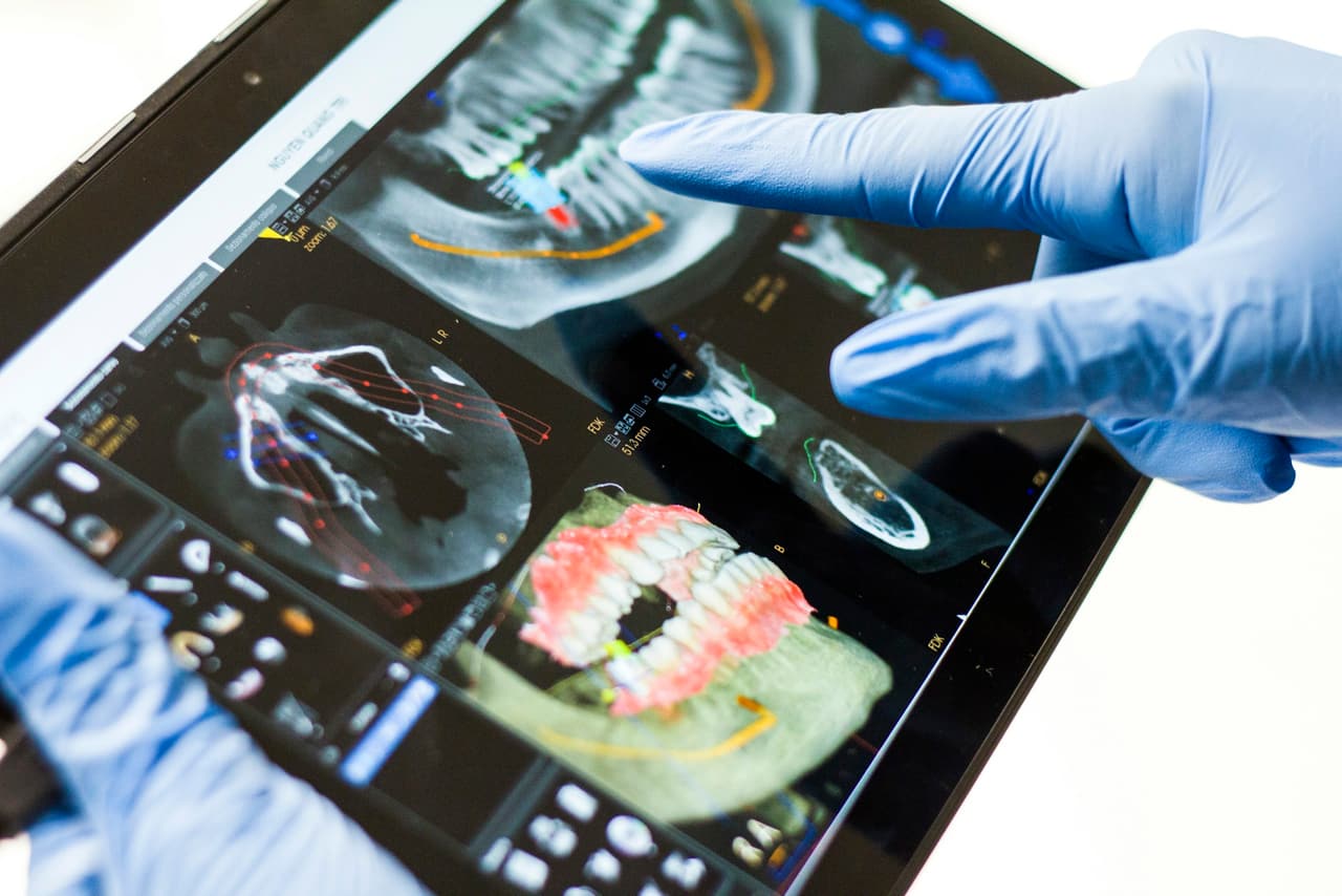 Mão enluvada apontando para uma tomografia odontológica em um tablet