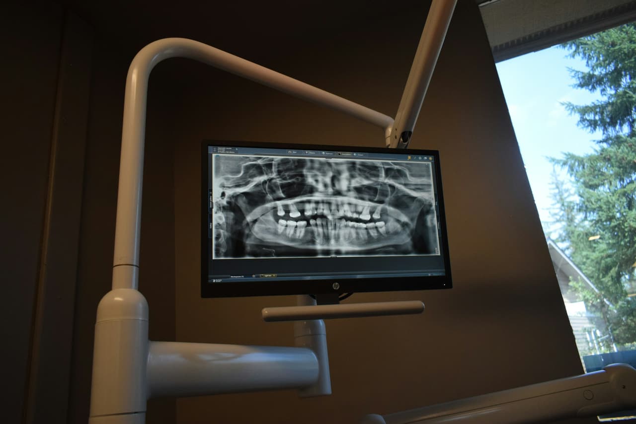 Radiografia panorâmica exibida em monitor no consultório